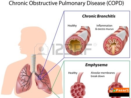  Б Р О Н Х О В И Т А Л - ЗА ДИШНИТЕ ПАТИШТА