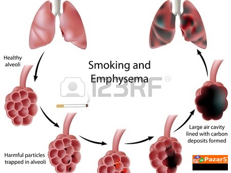  Б Р О Н Х О В И Т А Л - ЗА ДИШНИТЕ ПАТИШТА