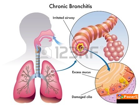  Б Р О Н Х О В И Т А Л - ЗА ДИШНИТЕ ПАТИШТА