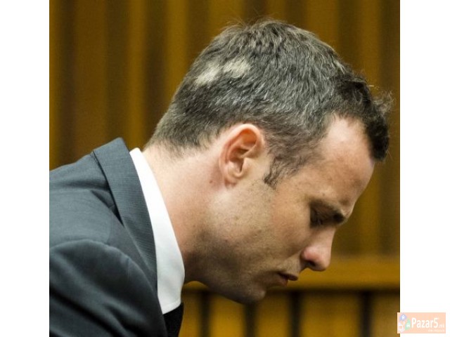 Лекување од Косопас (alopecia Areata)