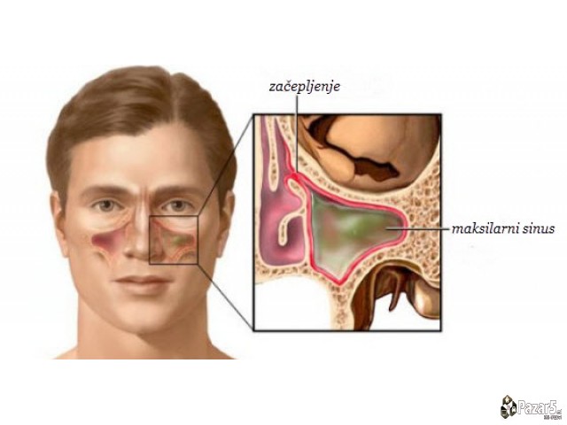 КАПКИ И МАСТ ЗА СИНУСИ и НОС