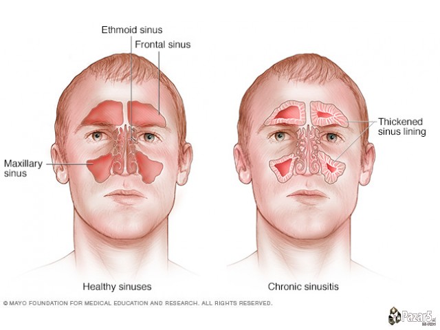 КАПКИ И МАСТ ЗА СИНУСИ и НОС