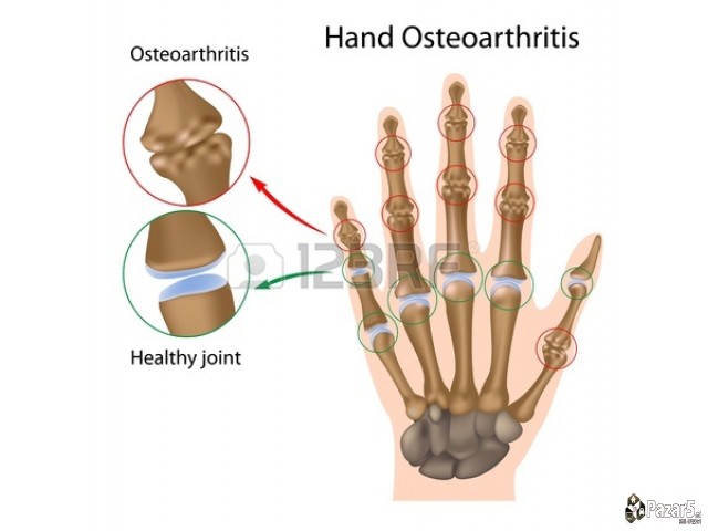 ГАВЕЗ - ГЕЛ,КРЕМА,МЕЛЕМ и КАПКИ од корен на ГАВЕЗ 
