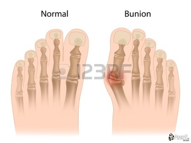 ГАВЕЗ - ГЕЛ,КРЕМА,МЕЛЕМ и КАПКИ од корен на ГАВЕЗ 
