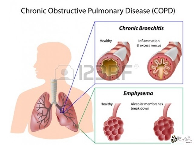 БРОНХОВИТАЛ