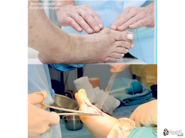 Ortopedsko Pomagalo Za Cukljevi