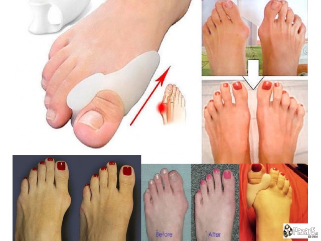 Ortopedsko Pomagalo Za Cukljevi